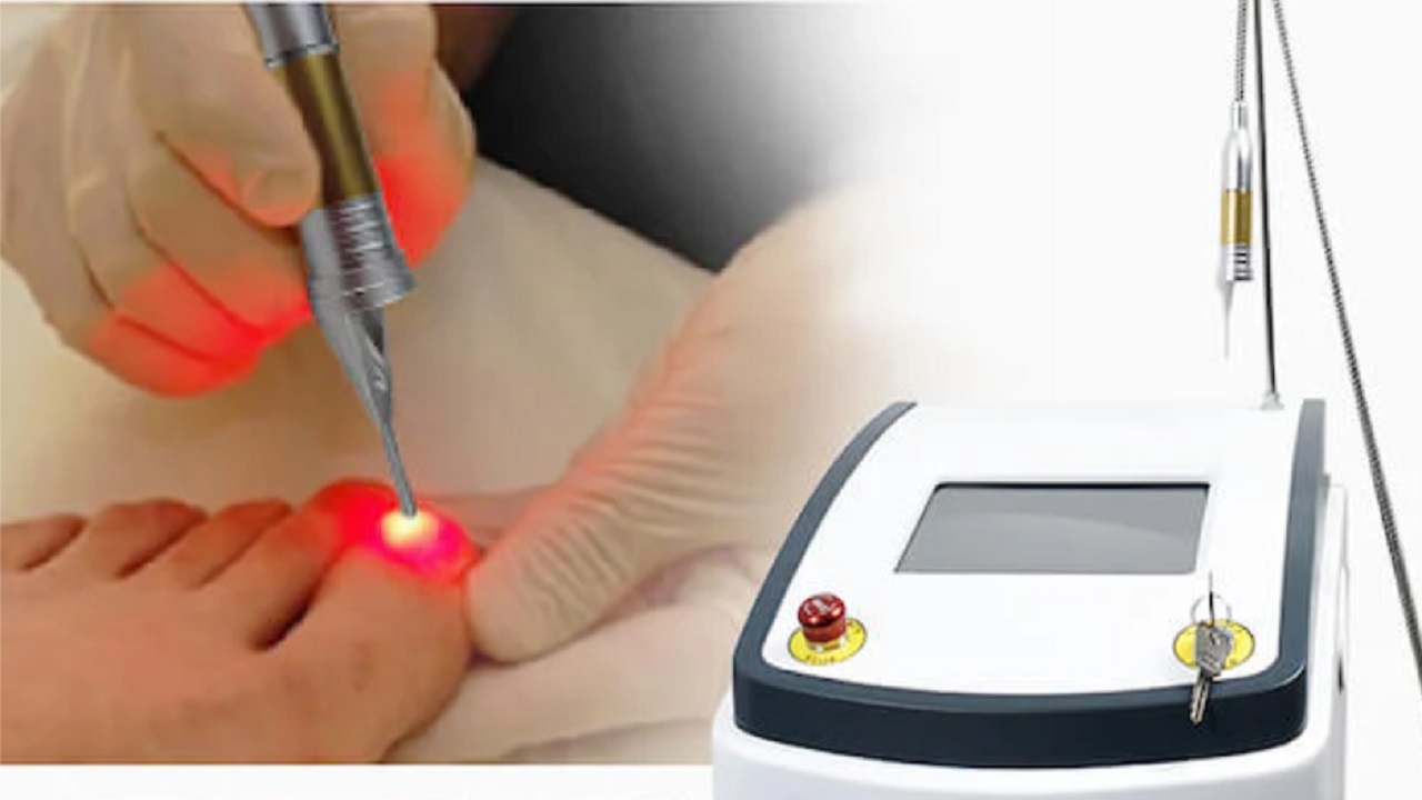 Harnessing the Power of Deep Tissue Class 4 Laser Therapy: A Comprehensive Guide